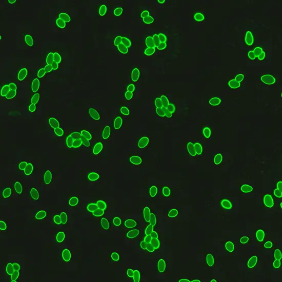 anti-saccharomyces cerevisiae (asca), igg